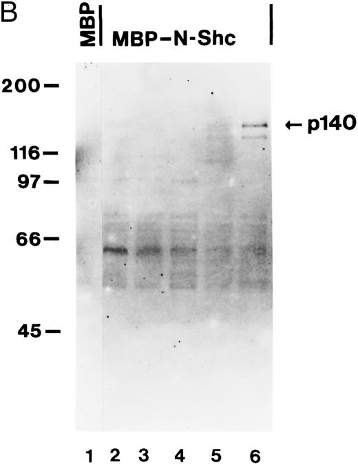 Fig. 5. The association between Shc and p140 is mediated through the PTB domain of Shc and this complex is constitutively activated in some AML. (A) hGM-CSF and CSF-1 induce the association of tyrosine-phosphorylated p140 with the PTB domain of Shc. Cell lysates from unstimulated (lanes 1, 3, and 5) or hGM-CSF–stimulated (lanes 2, 4, and 6) TF-1 cells or from unstimulated (lane 7) or CSF-1-stimulated (lane 8) BAC1.2F5 cells were immunoprecipitated with anti-Shc antibodies (lanes 1 and 2) or adsorbed with either MBP vector (lanes 5 and 6) or MBP fusion proteins containing the N-terminal PTB domain of Shc (MBP-N-Shc; lanes 3, 4, 7, and 8). Associated tyrosine-phosphorylated proteins were analyzed by antiphosphotyrosine immunoblotting. (B) p140 is constitutively associated with the PTB domain of Shc in AML. Cell lysates of unstimulated primary AML were either incubated with MBP vector protein (AML-3; lane 1) or MBP-N-Shc fusion protein (AML 3 through AML-7; lanes 2 through 6), and the adsorbed proteins were analyzed by antiphosphotyrosine immunoblotting. The AML samples analyzed in this experiment correspond to the AML-3 through AML-7 samples analyzed in Fig 4B, lanes 2 through 6.
