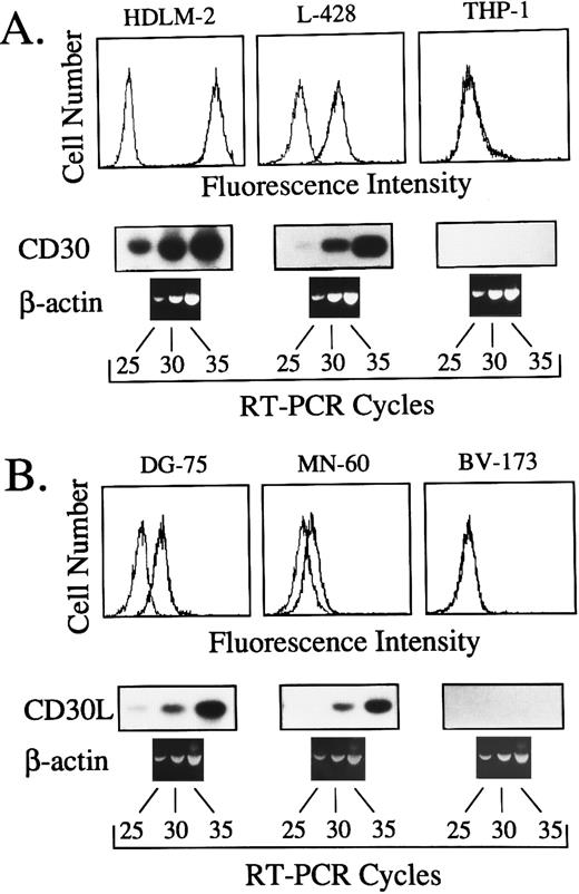 Fig. 1. (A) Comparison between surface expression of CD30, as detected by the MoAb M44 (upper panels), and the kinetics of cDNA amplification after 25, 30, and 35 cycles with primers specific for CD30 (lower panels) in the human cell lines HDLM-2, L-428 and THP-1. (B) Comparison between surface expression of CD30L, as detected by the MoAb M80 (upper panels), and the kinetics of cDNA amplification performed for 25, 30, and 35 cycles with primers specific for CD30L (lower panels) in the human cell lines DG-75, MN-60, and BV-173. In both cases, the same cDNA bulks were also amplified with primers specific for the housekeeping gene β-actin.