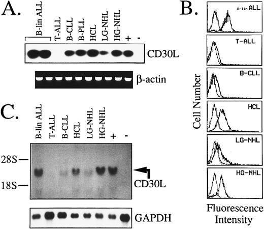 Fig. 5. Expression of CD30L in malignant cells from lymphoid tumors as assessed by RT-PCR (A), flow cytometry (B), and Northern blot analysis (C). (A) cDNA bulks were amplified with primer pairs specific for CD30L (upper panel) or β-actin (lower panel). The MN-60 and the BV-173 cell lines were used as positive (+) and negative (−) controls, respectively. (B) Flow cytometry analysis of representative cases of lymphoid malignancies. Cells were either incubated with the anti-CD30L MoAb M80 (bold line) or irrelevant isotype-matched mouse Ig (thin line), followed by PE-labeled goat antimouse Ig. The X- and Y-axes indicate the logarithm of the relative intensity of red fluorescence and relative cell numbers, respectively. (C) Northern blot analysis of the same cases shown in (B). Twenty micrograms of total RNA per lane was run on denaturated agarose gel, blotted onto nylon membranes, and hybridized with a CD30L-specific cDNA probe (upper panel) and with a GAPDH cDNA fragment (lower panel); +, positive control (MN-60 cell line); −, negative control (BV-173 cell line).