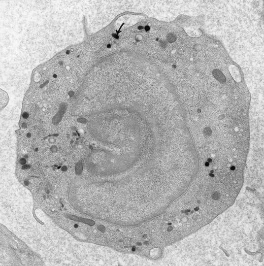 Peroxidase-positive lysosomes (arrow) in a peripheral blood monocyte. Original magnification × 16,000. (Courtesy of Ann M. Dvorak, MD, Department of Pathology, Beth Israel Hospital, Harvard Medical School, Boston, MA 02215.)