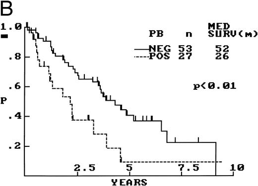 Fig. 5. (A) PB involvement in MCL is characterized by a polymorphous cell population including larger cells with immature nuclei and prominent nucleoli. (B) OS of 80 cases of MCL based on PB involvement at diagnosis. Those cases positive for PB involvement (n = 27) were associated with a significantly shorter survival when compared with those in which PB was not involved or not assessed (n = 53).