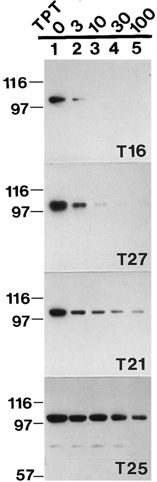 Fig. 3. Topo I band depletion assay in clinical leukemia samples. Aliquots of freshly isolated blasts from 4 different leukemia patients were incubated at 37°C for 30 minutes in buffer A containing 0 (lane 1), 3 μmol/L (lane 2), 10 μmol/L (lane 3), 30 μmol/L (lane 4), or 100 μmol/L TPT (lane 5); lysed; and subjected to SDS-polyacrylamide gel electrophoresis followed by Western blotting with anti-topo I antibody.