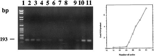 Fig. 10. Agarose gel electrophoresis of COX 2 RT-PCR products from total RNA extracted from neonatal monocytes as described in the Materials and Methods. RT-PCR using primers PGHS-2 1675 and PGHS-2 1868 was performed on RNA from unstimulated and 1,25-(OH)2D3 stimulated cells after 24 hours (lanes 1 and 2), 1 week (lanes 3 and 4), 2 weeks (lanes 5 and 6), and 3 weeks of culture (lanes 7 and 8) and on total RNA extracted from HL-60 unstimulated (lane 9) and 1,25-(OH)2D3 –stimulated adherent (lane 10) and floating cells (lane 11).