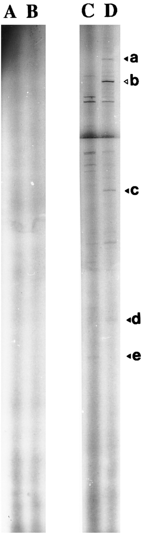 Fig. 2. Identification of 1,25(OH)2D3 -modulated genes transcription by DD-RT-PCR. DD-RT-PCR was performed on total RNA from unstimulated (lane C) and 1,25-(OH)2D3 –stimulated neonatal monocytes (lane D) as described in the Materials and Methods using primers T11CA and Ltk3 . Arrows indicate interesting labeled DNA products. Amplified double-stranded DNA corresponding to the amplification of 15-PGDH is noted as “b.” Total RNA samples pretreated by RNase A were used in the same experimental conditions to confirm the absence of genomic DNA contamination (lanes A, untreated cells; lane B, 1,25-(OH)2D3 –treated cells).