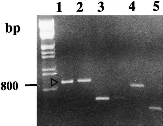 Fig. 3. Agarose gel electrophoresis of reamplified excised DNA. Reamplifications of bands we retained to study were performed as described in the Materials and Methods. Lanes 1, 2, 3, 4, and 5 correspond, respectively, to the DD-PCR–excised bands b, a, d, c, and e.