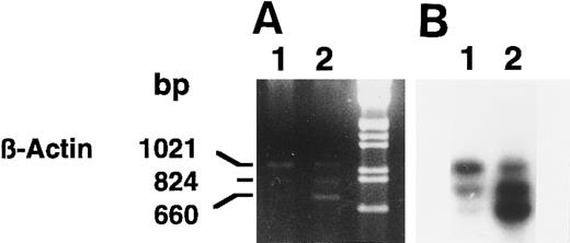 Fig. 4. Agarose gel electrophoresis (A) and autoradiography (B) of Southern blot of 15-PGDH and β-actin products from total RNA extracted from neonatal monocytes as described in the Materials and Methods. RT-PCR using 15-PGDH primers P27 and P850 and β-actin primers Acts 383 and Acts 1404, in the same tube, was performed on total RNA from unstimulated and 1,25-(OH)2D3 –stimulated cells after 1 week (lanes 1 and 2).