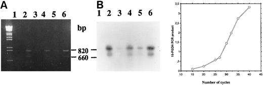 Fig. 5. Agarose gel electrophoresis (A) and autoradiography (B) of Southern blot of 15-PGDH RT-PCR products from total RNA extracted from neonatal monocytes as described in the Materials and Methods. RT-PCR using primers 15-PGDH primers P27 and P850 was performed on total RNA from unstimulated and 1,25-(OH)2D3 –stimulated cells after 1 week (lanes 1 and 2), 2 weeks (lanes 3 and 4), and 3 weeks of culture (lanes 5 and 6).