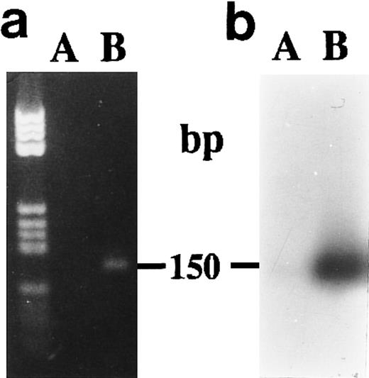 Fig. 6. Agarose gel electrophoresis (a) and autoradiography (b) of Southern blot of RT-PCR products obtained from total RNA extracted from neonatal monocytes. The amplification of both 15-PGDH and iso-15-PGDH RNA(s) using 15-PGDH primers P700 and P850 from 1 μg of total RNA was performed after 1 week of culture on RNA from unstimulated (lane A) and 1,25-(OH)2D3 –stimulated cells (lane B).