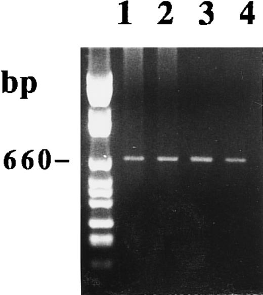 Fig. 7. Agarose gel electrophoresis of 15-PGDH RT-PCR products from total RNA extracted from adult monocytes as described in the Materials and Methods. RT-PCR using primers 15-PGDH 27 and 15-PGDH 850 were performed on RNA from two samples of unstimulated and 1,25-(OH)2D3 –stimulated monocytes after 1 week of culture. Lanes 1 and 2 correspond, respectively, to untreated and treated monocytes (sample 1). Lanes 3 and 4 correspond, respectively, to untreated and treated monocytes (sample 2).