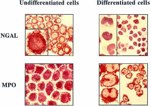 Fig. 5. Immunocytochemistry of undifferentiated and differentiated transfected HL-60 cells. Cytospin of undifferentiated (left panels) and DMSO/RA-differentiated (right panels) transfected HL-60 cells containing NGAL cDNA were fixed in 4% formaldehyde in 0.1 mol/L phosphate buffer, permeabilized with Triton X-100, and labeled with affinity-purified rabbit anti-NGAL antibody (2.5 μg/mL; upper panel) or anti-MPO antibody (76 μg/mL; lower panel).