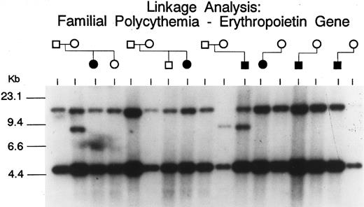 Fig. 2. Southern blot analysis of the erythropoietin gene (digested with Bgl II) in six polycythemic Chuvash patients and some of their first-degree relatives. The higher molecular weight Bgl II fragment is polymorphic, with the ∼15 kb wild allele having an 8 kb partner. A mother of the polycythemic patient in the third pedigree (an obligate carrier assuming autosomal recessive inheritance) is homozygous for the poymorphic allele, while her affected son is heterozygous. These data suggest that neither allele is linked to polycythemia.