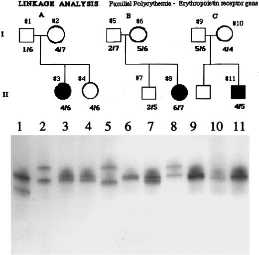 Fig. 3. Analysis of the GGAA minisatellite repeat of the erythropoietin receptor gene in three polycythemic Chuvash patients and some of their first-degree relatives. As shown in the autoradiogram of the PCR analysis of this locus, several different alleles are present in the affected subjects, in their parents (obligate carriers assuming autosomal recessive inheritance), and in siblings. Because the subjects with polycythemia are not homozygous for one or a restricted number of alleles, these data do not suggest linkage of polycythemia to the erythropoietin receptor gene.