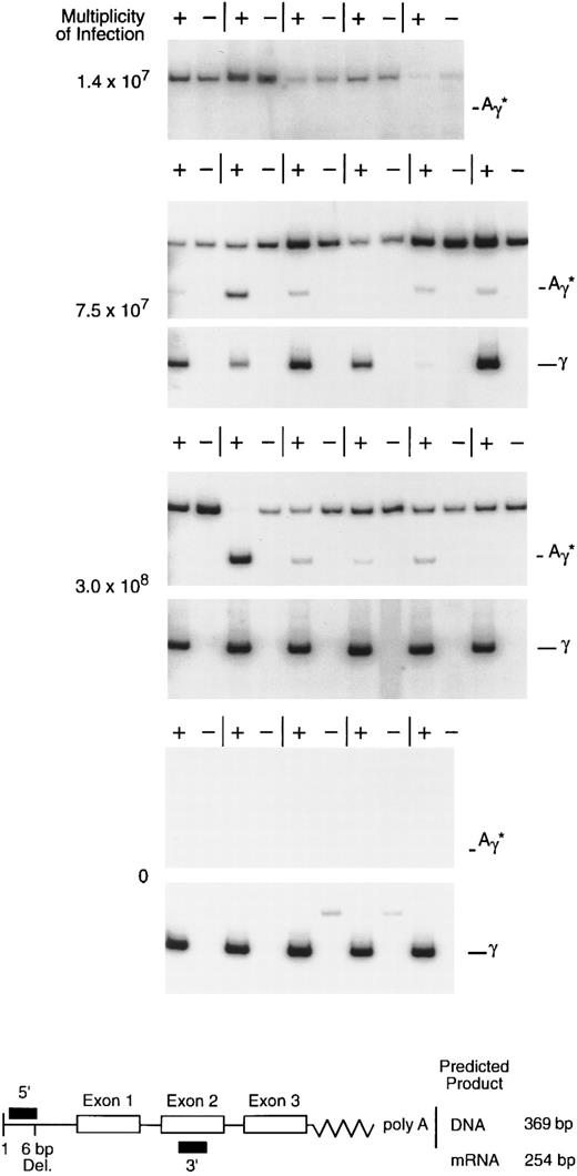 Fig. 1. rHS432Aγ*-mediated gene transfer and expression in primary, progenitor-derived, human erythroid colonies. CD34-selected bone marrow cells were exposed to rAAV at various multiplicities of infection and cultured, and individual colonies were analyzed for mRNA at 14 to 16 days. The diagram below shows the design of the RT-PCR analysis; the upper band (369 bp), when present, is derived from genomic or vector DNA regardless of the use of reverse transcriptase (+ or −), whereas the lower (254 bp) reverse transcriptase-dependent band (+) is derived from processed globin mRNA. The 5′ primer designed to detect the Aγ* mRNA spans a 6-bp deletion in the 5′ untranslated region (diagram below), whereas the 5′ primer designed to detect the wild-type γ mRNA includes the deleted sequences (not shown). The upper band with the Aγ* primers in several of the figures is derived from rAAV vector particles, episomal DNA, or possibly integrated rAAV genomic DNA; its presence in the absense of Aγ* gene expression (upper panel, 1.4 × 107 MOI) suggests that this signal may be derived from particle DNA or intracellular, single-stranded DNA.