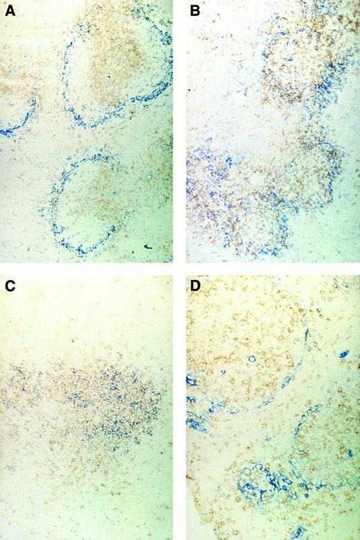 Fig. 5. Immunohistochemical pictures of frozen tissue sections, double-stained for CD4 (brown) and sialoadhesin (blue) (A and B) and for CD4 (brown) and CD8 (blue) (C and D) in spleens of normal control mice (A and C) or ESb-MP tumor-bearing mice (d28) 5 days after ADI treatment (B and D) (original magnification × 160).
