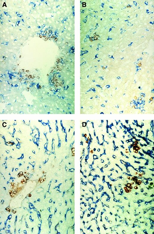Fig. 6. Immunohistochemical pictures of frozen tissue sections, double-stained for CD4 (brown) and sialoadhesin (blue) (A and B) and for β2Mb (brown) and sialoadhesin (blue) (C and D) in livers from tumor-bearing mice (d43) 20 days after ADI treatment. (A and C) Areas of portal vein (original magnification × 160); (B and D) areas of parenchyma (original magnification × 160).