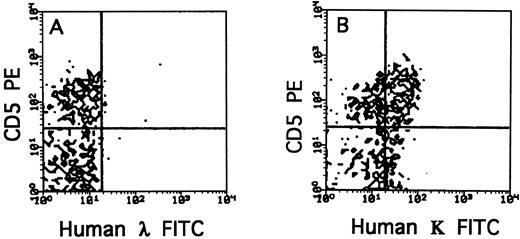Fig. 2. Phenotypic characterization of light chain expressed on CD5+CD20+ lymphocytes recovered from human-<Balb/c chimera. Chimera were prepared by conditioning Balb/c mice with split irradiation followed by radioprotection with SCID BM; thereafter, the mice were transplanted with 100 to 1,000 × 106 human PBMC from BCLL patients. Cells were recovered from the peritoneum wash 14 days after transplantation.