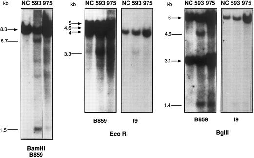 Fig. 1. Southern blot analysis of BamHI-, EcoRI-, and Bgl II-digested DNA from patients no. 593 and 975, compared with a placenta negative control (NC). The sizes (in kilobases) of the germline bands are indicated by arrows and the rearranged bands as lines. The 2 faint ≈4- and ≈4.3-kb bands in the BamHI digest from patient no. 593 are probably due to star activity, because they are not seen in other digests.