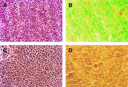 Fig. 1. Comparison of thymic histology and RBTN-2 expression in MSH2 −/− mice before the development of lymphoma and MSH2 −/− mice with thymic lymphoblastic lymphoma (A-D). (A) Thymic histology from 8-week-old MSH2 −/− mouse before the development of lymphoma, original magnification (OM) × 500. (B) Thymic tumor histology from 4-month-old MSH2 −/−, OM × 500. Note the uniform morphologic appearance of the tumor cells with fine nuclear chromatin, inconspicuous nucleoli, scant cytoplasm, and numerous mitotic figures consistent with lymphoblastic lymphoma. (C) RBTN-2 protein expression by immunohistochemistry in thymus of MSH2 −/− mouse before the development of lymphoma, OM × 1,000. (D) MSH2 −/− thymic tumor, OM × 1,000. Immunohistochemistry showed strong RBTN-2 protein expression in thymic tumor only.