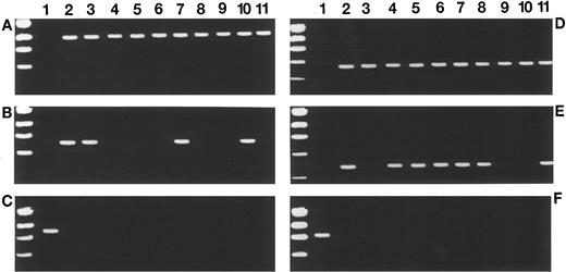 Fig. 2. Proto-oncogene expression profiles in MSH2 −/− mice and human LBL by RT-PCR (A-F). Results of RBTN-2, TAL-1, and HOX-11 expression in 10 representative MSH2 −/− thymic tumors are shown in (A), (B), and (C), respectively. Lane 1 in (A) and (B) represent amplification from MSH2 −/− thymic tissue before the development of lymphoma (negative control) and lane 1 in (C) represents a positive control with amplification using cDNA from day 9 ES cells. RBTN-2 expression is detected in all MSH2 −/− thymic tumors, TAL-1 is detected in 40%, while none express HOX-11. (D), (E), and (F) show the expression profiles of RBTN-2, TAL-1, and HOX-11, respectively, in 10 cases of human LBL. Lane 1 in (D) and (E) represent amplification using normal human lymphocyte cDNA (negative control). Lane 1 in (F) is a positive control from SiL-1, a human T-cell acute lymphoblastic leukemia (ALL) cell line. Expression of RBTN-2, TAL-1, and HOX-11 is detected in 100%, 70%, and 0% of the cases, respectively.