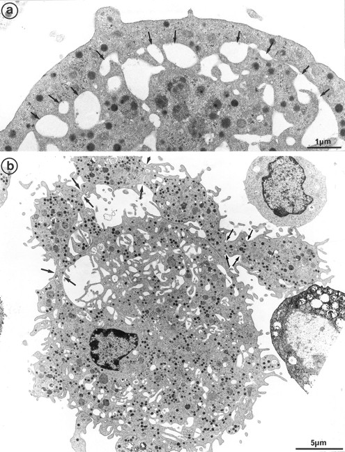 Fig. 3. Cultured MK grown for 7 days from CD34+CD38+ progenitors in the presence of Mpl-l, and presenting signs of platelet formation. (a) This mature MK displays alignment and dilatation of some peripheral demarcation membranes, individualizing an outer ring of cytoplasm (arrows). (b) The peripheral sheet of cytoplasm has unfolded from the cell core. Constriction zones are regularly disposed along this cytoplasmic extension (arrows).