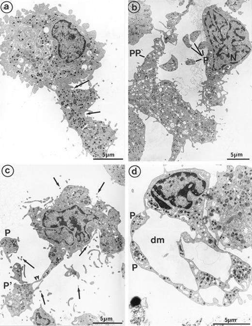 Fig. 4. Sample of cultured MK grown for 7 days from CD34+CD38+ progenitors in the presence of Mpl-l, showing some evidence of platelet formation and shedding. (a) A cytoplasmic process extends straight from the cell core. Constriction zones seem to individualize already distinct platelet fields of large size, close to the MK core (arrows). (b) The appearance of this mature MK is consistent with the process of shedding platelets: The nucleus (N) displays condensed heterochromatin, and its shape is indented. Several platelet-sized cytoplasmic fragments have clearly detached from the MK (P). A large cytoplasmic fragment deprived of nuclear material and possibly corresponding to a detached proplatelet (PP) is also shown. (c) Before releasing platelets, a constriction zone (arrowheads) is formed between the mother cell and the forming platelet (P′). A few detached platelets (P) seem to have already detached, as well as numerous microparticles (arrows). (d) Considerable dilatation of the demarcation membrane system (dm) leads to the demarcation of future platelet fields (P).