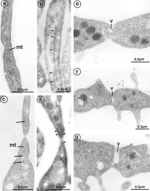 Fig. 5. High magnification of the constriction zones observed on mature MKs (grown for 7 days from CD34+CD38+ progenitors in the presence of Mpl-l). (a) Some elongated parallel microtubules (mt) are present along the length of the cytoplasmic extension separating the platelet buds. (b) Immunogold labeling for tubulin confirms its presence in the length of the elongated arm separating platelet territories (arrowheads). (c) On each side of the constriction area, transverse microtubule fragments (mt) are observed near the longitudinal microtubules (arrows). (d) Immunogold labeling for tubulin confirms its concentration on each side of the constriction zone (arrowheads). (e, f, and g) A vacuole of increasing size (v) is formed at the constriction zone, which may lead to detachment of the platelet fragment.