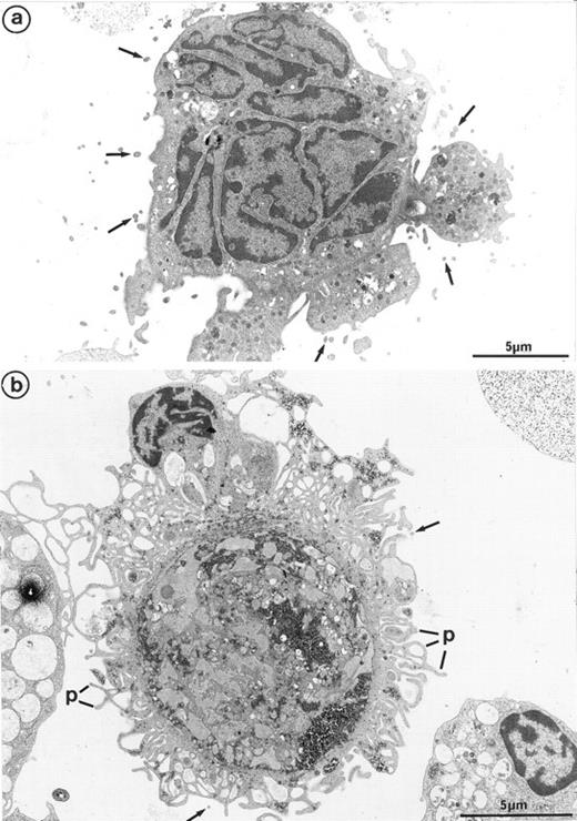 Fig. 7. (a) MK grown for 7 days from CD34+CD38+ progenitors in the presence of Mpl-l: numerous microparticles (arrows) surround this platelet-shedding mature MK. (b) Cultured MK having undergone thrombin activation (1 U/mL for 5 min): the plasma membrane is bristled with numerous pseudopods (p). However, unlike platelet-shedding MKs, only a few microparticle profiles are seen around the cell surface (arrows), probably corresponding to some pseudopod transverse sections.