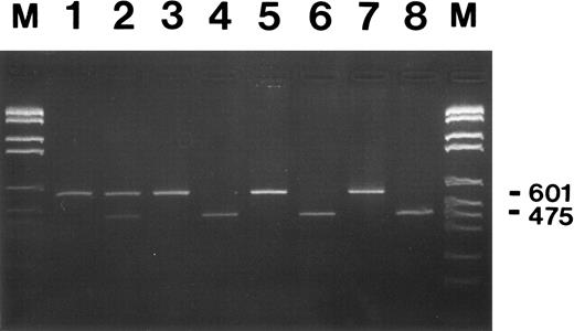 Fig. 3. Restriction enzyme analysis of G-CSF receptor RT-PCR products from neutrophils of patient MA and her family members. Neutrophils from congenital neutropenia patient MA who developed secondary AML (lanes 1 and 2), her brother FA, also a congenital neutropenia patient, (lanes 3 and 4), their healthy mother (lanes 5 and 6), and father (lanes 7 and 8) were used for RNA isolation and subsequent RT-PCR analysis. PCR fragments amplified with primers Q1 and P2 are either shown undigested (lanes 1, 3, 5, and 7) or digested with PvuII (lanes 2, 4, 6, and 8) at 37°C overnight and after agarose gel electrophoresis and ethidium bromide staining. Numbers on the right indicate the undigested (601) and the digested (475) PCR fragments. The smaller digested fragment of 126-bp is not shown. DNA fragments lengths standard M.VI from Boehringer Mannheim was loaded in lanes M (2176, 1766, 1230, 1033, 653, 517, 453, 394, 298, 234 bp).