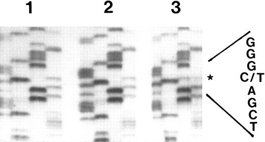 Fig. 4. Nonradioactive direct sequencing of RT-PCR fragments of the G-CSF receptor cytoplasmic domain in myeloid cells from congenital neutropenia patients. G-CSF receptor cDNA from neutrophils of congenital neutropenia patient MA before (lane 2) and at the time point of diagnosis of AML (lane 3) and from her brother FA, who is also a congenital neutropenia patient, but who has not yet developed AML (lane 1), was amplified with primers Q1 and Q2 and sequenced directly. In each lane, the nucleotides are shown in the following order: GATC. The asterisk indicates the position of the point mutation.