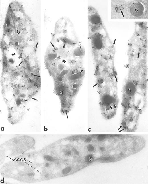 Fig. 1. Ultrathin frozen sections of human (a and b), Wistar rat (c and d), and mouse platelets (inset) immunolabeled with polyclonal antibodies to Fyn (a), Lck (b and c), and Fgr (inset). (d) Section of a Wistar rat platelet incubated with Lck peptide–absorbed anti-Lck antibodies. Arrows indicate label for these Src-related kinases on platelet plasma membranes and electron-dense cytoplasmic patches. Arrowheads indicate clusters of label closely associated with alpha granule (G) membranes. Asterisks indicate lumena of the SCCS system, a channel system in continuity with the outside space. (a) Original magnification × 43,000; (b) × 43,000; (c) × 50,000; (d) × 46,000; (inset) × 70,000.