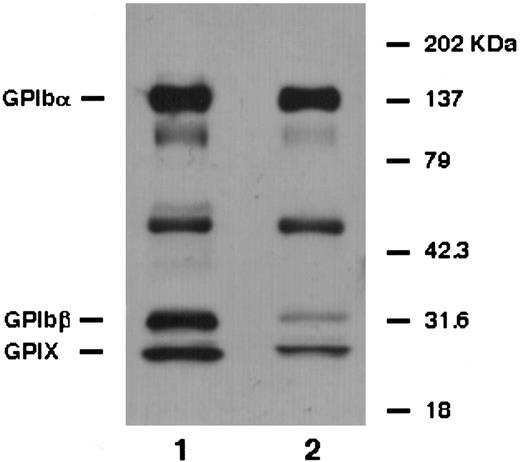 Fig. 4. Immunoprecipitation analysis. Biotin-labeled platelet proteins from a normal individual (lane 1) and the patient (lane 2) were immunoprecipitated with anti-GPIbα antibody (HPL7) and analyzed under reduced conditions. From the patient's platelets, it predominantly precipitated GPIbα and a small amount of GPIbβ and GPIX. Moreover, the amount of GPIbβ was less than GPIX.