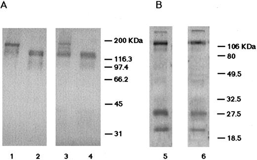 Fig. 5. Immunoblot analysis. (A) The immunoblots probed with the rabbit antiglycocalicin antibodies. In lanes 1 and 2, 10 μg of the solubilized normal platelets was applied. In lanes 3 and 4, 20 μg of the solubilized patient's platelets was applied. Conditions were nonreduced (lanes 1 and 2) and reduced (lanes 3 and 4). (B) The immunoblots probed with the rabbit anti-GPIb/IX complex antibodies. Lane 5, normal platelets (10 μg protein) under reduced conditions; lane 6, the patient's platelets (20 μg protein) under reduced conditions. In the patient's platelets, the amount of normal nonreduced GPIb was decreased and the majority of GPIbα was not disulfide linked with GPIbβ. GPIbβ and GPIX were identified with normal electrophoretic mobilities.