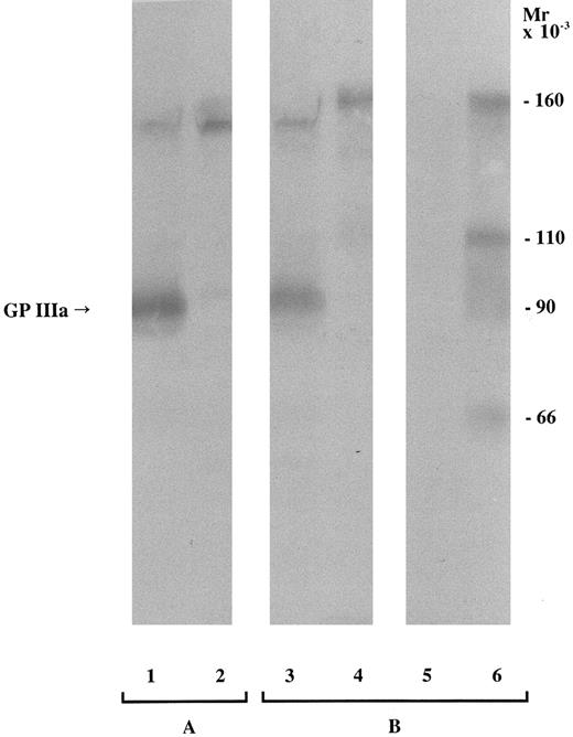 Fig. 1. Immunoblot of SDS-soluble platelet proteins subjected to SDS-PAGE (6.5% polyacrylamide gel) under nonreduced conditions and transferred to nitrocellulose membrane. For each sample, 150 μg total platelet protein was loaded. An anti–HPA-1a serum was used as a positive control (A), and the mother's serum was tested (B). Lanes: (1) HPA-1–positive platelets, (2) HPA-1–negative platelets, (3) father's platelets, (4) mother's platelets, (5) supernatant recovered after α-chymotrypsin treatment and sedimentation of the father's platelets, and (6) pellet after α-chymotrypsin treatment and centrifugation of the father's platelets. The band at ≈160 kD represents platelet-associated IgG.