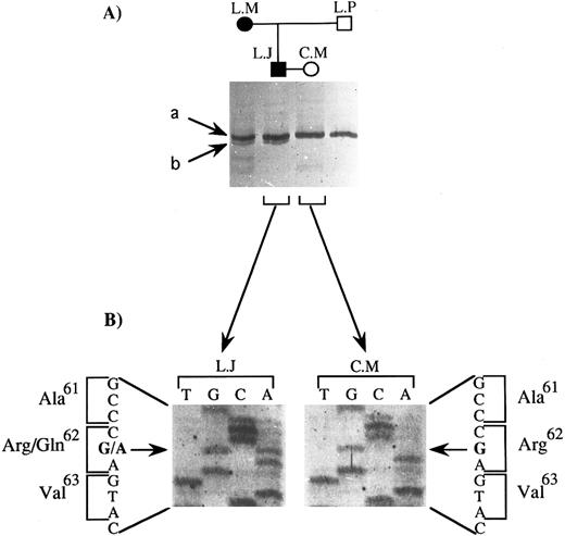 Fig. 2. SSCP analysis and sequencing of exon 3 of the GPIIIa gene: identification of the mutation carried by the father (L.J.). (A) SSCP analysis of exon 3 of 4 family members. Two bands, a and b, were seen for L.J. and L.M., for whom C.M.'s serum was reactive against their platelets, while only band a was observed for C.M. and L.P., for whom C.M.'s serum was unreactive against their platelets. (B) Direct DNA sequencing of the corresponding amplification product for L.J. and C.M. The position of the mutation is indicated with a horizontal arrow, and the substituted base with a bold letter; the amino acid substitution is indicated together with its position in the GPIIIa protein.