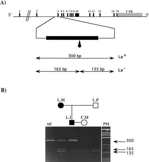 Fig. 3. ASRA on exon 3 of the GPIIIa gene from family members. (A) Genomic organization of the GPIIIa gene. The 15 exons are symbolized by vertical black bars, and the exon number is indicated; UTR refers to the untranslated region. The vertical arrow indicates the target sequence recognized by the Ava I restriction enzyme in the published sequence.19 The size of restriction fragments resulting from Ava I digestion of exon 3 for the La genotype is indicated (La+, mutated type; La−, wild-type). (B) A 10% polyacrylamide gel on which was loaded amplification products containing exon 3 of the gene for GPIIIa: nd, undigested amplification product from a normal donor, amplification products from L.M., L.J., C.M., and L.P. digested with the Ava I restriction enzyme. PM, pGEM DNA Markers (Promega). The size of each DNA fragment, in base pairs, is shown by horizontal arrows.
