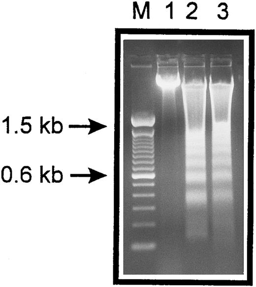 Fig. 2. Internucleosomal DNA fragmentation. HUVECs treated with staurosporine (lane 2) or kept in suspension with serum deprivation (lane 3) for 6 hours were lysed and total cellular DNA was separated on a 2% agarose gel. HUVECs in lanes 2 and 3 show typical oligonucleosomal banding. Lanes M and 1 represent molecular weight markers (in kilobases) and normal HUVECs, respectively.
