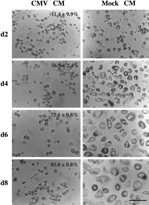 Fig. 4. HCMV-induced factor alters monocyte differentiation. Purified human primary monocytes were incubated with the day 2 virus-free CMV CM (picture on the left) or the mock CM (picture on the right) (see legend to Fig 3). The percentage of oxidative activity inhibition (mean ± SD) are shown. The scale is shown by the bar which is equal to 80 μm. These results are representative of two independent experiments. After 2 days of culture, approximatly 20% of the monocytes incubated with the mock CM appeared to be slightly bigger in size and some of them had started to spread. However, monocytes incubated with the CMV CM remain small, rounded with prominent membrane ridges. At this time, no significant difference in monocyte oxidative activity is detected (see Fig 3). After 4 days, morphologic changes were obvious, with the majority of the monocytes flattened and spread, increased greatly in size, and showing a higher cytoplasm to nucleus ratio. In contrast, cells treated with the CMV CM maintained the phenotype of undifferentiated monocytes. In correlation, the oxidative activity of mock CM treated cells dramatically increased from 0.272 ± 0.036 to 0.698 ± 0.011, whereas it remained low, 0.301 ± 0.019, in CMV CM–treated monocytes (Fig 3). After 6 days, the cell size increased and the cell spreading was more pronounced. The cytoplasm to nucleus ratio was significantly augmented and membrane ruffles and numerous cytoplasmic granules and lipid inclusions were observed. In parallel, the oxidative activity of mock CM treated cells increased to 0.815 ± 0.022 but remained low, 0.199 ± 0.002, in CMV CM–treated monocytes (Fig 3). After 8 days, mock CM–treated monocytes presented similar morphologic characteristics as day 6 with increasing cell size and increasing oxidative activity (Fig 3), whereas these parameters remained unchanged in CMV CM–treated monocytes.