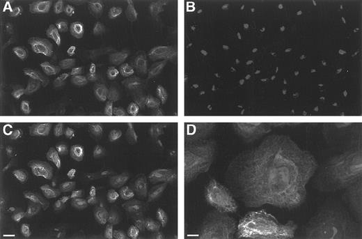 Fig. 1. Scanning laser confocal microscopy of TECs in monolayer cultures. (A) Depicts a relatively low power view of staining with the directly FITC-labeled pan-cytokeratin antibody (PKC-26) showing that the majority of TEC cells in the monolayers are cytokeratin positive. (B) Represents the same field stained with propidium iodide to reveal the cell nuclei and (C) is the merged image showing that essentially all the cells are cytokeratin positive (bar = 11.3 μm). (D) Is a higher power image of TECs showing the characteristic filamentous structure of cytokeratin expressed by epithelial cells (bar = 7.2 μm).