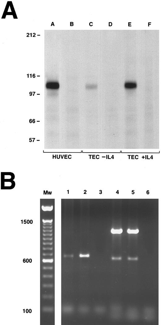 Fig. 3. Detection of VCAM-1 expression on cultured human TECs by immunoprecipitation (A) and PCR (B). (A) Immunoprecipitation of VCAM-1 from detergent lysates of biotin-labeled TECs (with or without rIL-4 pretreatment) or HUVEC (with TNF pretreatment). Immunoprecipitations with a control MoAb are shown in lanes B, D, and F. Immunoprecipitations with a combination of anti-VCAM-1 MoAbs (4B9 and 1G11) are shown in lanes A, C, and E. The constitutive expression of VCAM-1 (TEC-IL-4) is compared to the expression after overnight culture in IL-4 (TEC + IL-4). The apparent Mw of the major band (∼110 kd) in lanes A, C, and E is consistent with VCAM-1. (B) PCR analysis of VCAM-1 expression. Lanes 1 (unstimulated TEC) and 2 (IL-4 stimulated TEC) show a single major band at an apparent Mw of 650 kb consistent with the 7-domain form of VCAM-1. Lanes 4 and 5 are the actin controls for the same cells. Lanes 3 and 6 are the negative water controls.