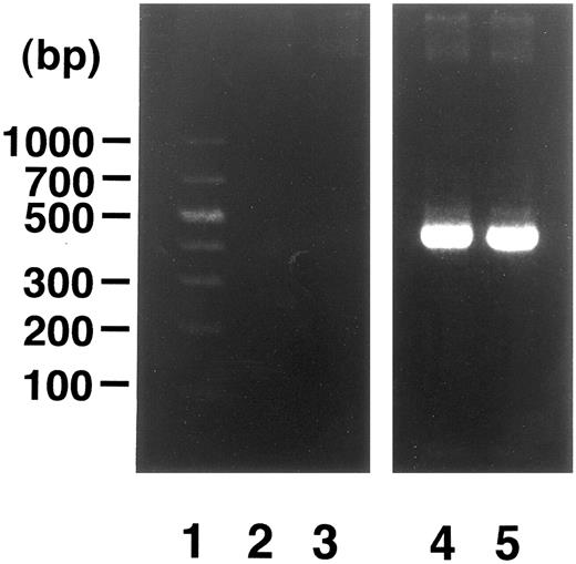 Fig. 4. Analysis of MRP gene expression in case 4. DNA molecular size marker (lane 1); MRP gene expression in cells from time points indicated in Fig 2 (lanes 2 and 3); β-actin band in each point (lanes 4 and 5). RT-PCR was performed as described in Materials and Methods.