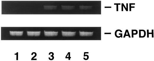 Fig. 7. Analysis of TNF gene expression. KG-1 cells (lane 1); KG-1 (pSV2neo) KP2 cells (lane 2); KG-1 (pTNFΔpro) KD3 cells (lane 3); KG-1 (pTNFΔpro) KD5 cells (lane 4); KG-1 (pTNFΔpro) KD10 cells (lane 5). RT-PCR was performed as described in Materials and Methods.