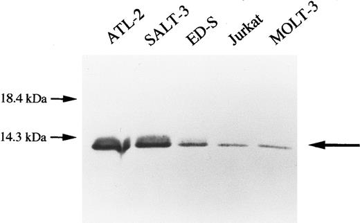 Fig. 1. Expression of ADF in T-cell leukemia cell lines. Cell lysates (40 μg) were electrophoresed by 12% SDS-PAGE under reducing conditions and transferred to polyvinylidenedifluoride membranes. Immunostaining was performed using anti-ADF antibody as the first antibody.
