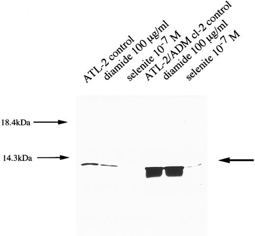Fig. 10. Expression of ADF in ATL cell lines after treatment with diamide and selenite. Cell lysates (40 μg) were electrophoresed by 12% SDS-PAGE under reducing conditions and transferred to polyvinylidenedifluoride membranes. Immunostaining was performed using anti-ADF antibody as the first antibody.
