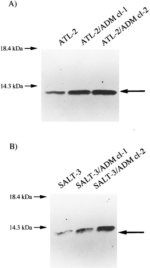 Fig. 2. Expression of ADF in ATL cell lines. Cell lysates (40 μg) were electrophoresed by 12% SDS-PAGE under reducing conditions and transferred to polyvinylidenedifluoride membranes. Immunostaining was performed using anti-ADF antibody as the first antibody. (A) ATL-2, ATL-2/ADM cl-1, and ATL-2/ADM cl-2; (B) SALT-3, SALT-3/ADM cl-1, and SALT-3/ADM cl-2