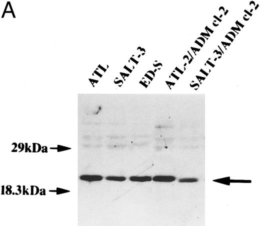 Fig. 6. Expression of GSH-Px in T-cell leukemia cell lines. (A) Western blot analysis. Cell lysates (4 μg) were electrophoresed by 12% SDS-PAGE under reducing conditions and transferred to polyvinylidenedifluoride membranes. Immunostaining was performed using anti–GSH-Px antibody as the first antibody. (B) Correlation between the IC50 and the activity of GSH-Px in T-cell leukemia cell lines. GSH-Px activity showed no correlation with the resistance to ADM (r = .22).