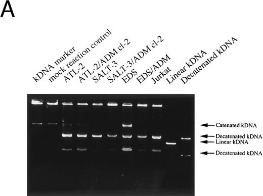Fig. 7. Topoisomerase II activity. (A) Agarose gel electrophoresis; (B) correlation between topoisomerase II activity and the IC50 of ADM in T-cell leukemia cell lines. Topoisomerase II activity showed no correlation with the resistance to ADM (r = .19).