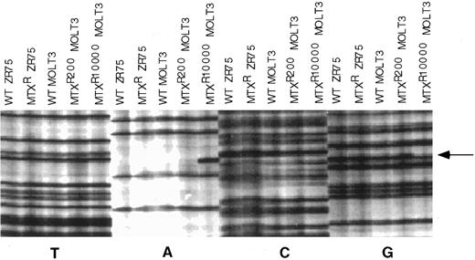 Fig. 3. Nucleotide sequencing gel of individual cDNA clones of the nucleotide sequence in the region of RFC1 codon 25. The sequencing gel was arranged so that all dideoxy termination reactions for the different templates were grouped together, which facilitated recognition of aberrant sequences. cDNAs included in the gel were from WT ZR-75 human breast cancer cell line, a transport-deficient MTX-resistant ZR-75 cell line,8 WT MOLT-3, MOLT-3/MTX200, and MOLT-3/MTX10,000 cells. Arrow designates site of mutation in the MOLT-3/MTX10,000 cDNA clone.