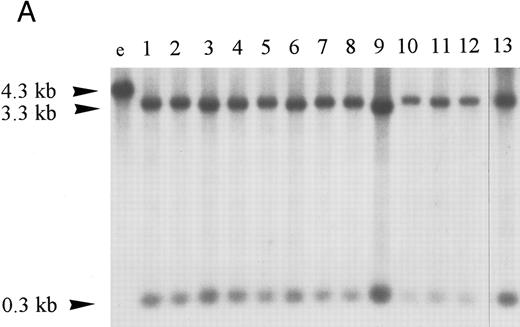 Fig. 2. Homozygous deletion and methylation of 5′ CpG islands of p16 and p15 in MM. Lanes 1 through 12 in (B) and (C) correspond to patients no. 1 through 12 as described in the tables. (A) Southern blot analysis with the p16 exon 1 probe for normal samples (blood and BM aspirate). Lane e is normal blood DNA restricted with EcoRI alone (the 4.3-kb band simulates the fragment size seen as if the SacII sites are methylated). Lanes 1 through 12 (normal blood) and lane 13 (marrow) are DNA all restricted with EcoRI plus SacII. All lanes show no methylation band but two smaller fragments of 3.3 and 0.3 kb, which indicate absence of methylation. (B) Southern blot analysis with the p16 exon 1 probe for MM. For reference, lanes a and b are, respectively, normal blood DNA restricted with EcoRI alone (lane a, a 4.3-kb fragment simulates the fragment size seen as if the SacII sites are methylated) and EcoRI plus SacII (lane b, two smaller fragments of 3.3 and 0.3 kb, representing unmethylation status). Lanes 1 through 12 are MM DNA all restricted with EcoRI and SacII. Lanes 4, 7, and 9 show no retention of the 4.3-kb methylation bands and hence unmethylated states. All others show aberrant methylation with mixtures of 4.3-, 3.3-, and 0.3-kb fragments. (C) Southern blot analysis with the p15 exon 1 probe for MM. Similarly, lanes c and d are, respectively, normal blood DNA restricted with HindIII alone (lane c, a 2.8-kb fragment simulates the fragment size seen as if the Eag I site is methylated) and HindIII plus Eag I (lane d, two smaller fragments of 2.2 and 0.5 kb, represent unmethylation status). *An unidentified fragment recognized by the p15 exon 1 probe. Lanes 1 through 12 are MM DNA all restricted with HindIII and Eag I. Lanes 4, 7, 9, and 10 show 2.2- and 0.5-kb fragments and, hence, unmethylated states. All other lanes show the 2.8-, 2.2-, and 0.5-kb fragments and, hence, the presence of aberrant methylation.