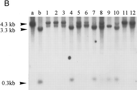 Fig. 2. Homozygous deletion and methylation of 5′ CpG islands of p16 and p15 in MM. Lanes 1 through 12 in (B) and (C) correspond to patients no. 1 through 12 as described in the tables. (A) Southern blot analysis with the p16 exon 1 probe for normal samples (blood and BM aspirate). Lane e is normal blood DNA restricted with EcoRI alone (the 4.3-kb band simulates the fragment size seen as if the SacII sites are methylated). Lanes 1 through 12 (normal blood) and lane 13 (marrow) are DNA all restricted with EcoRI plus SacII. All lanes show no methylation band but two smaller fragments of 3.3 and 0.3 kb, which indicate absence of methylation. (B) Southern blot analysis with the p16 exon 1 probe for MM. For reference, lanes a and b are, respectively, normal blood DNA restricted with EcoRI alone (lane a, a 4.3-kb fragment simulates the fragment size seen as if the SacII sites are methylated) and EcoRI plus SacII (lane b, two smaller fragments of 3.3 and 0.3 kb, representing unmethylation status). Lanes 1 through 12 are MM DNA all restricted with EcoRI and SacII. Lanes 4, 7, and 9 show no retention of the 4.3-kb methylation bands and hence unmethylated states. All others show aberrant methylation with mixtures of 4.3-, 3.3-, and 0.3-kb fragments. (C) Southern blot analysis with the p15 exon 1 probe for MM. Similarly, lanes c and d are, respectively, normal blood DNA restricted with HindIII alone (lane c, a 2.8-kb fragment simulates the fragment size seen as if the Eag I site is methylated) and HindIII plus Eag I (lane d, two smaller fragments of 2.2 and 0.5 kb, represent unmethylation status). *An unidentified fragment recognized by the p15 exon 1 probe. Lanes 1 through 12 are MM DNA all restricted with HindIII and Eag I. Lanes 4, 7, 9, and 10 show 2.2- and 0.5-kb fragments and, hence, unmethylated states. All other lanes show the 2.8-, 2.2-, and 0.5-kb fragments and, hence, the presence of aberrant methylation.