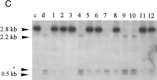 Fig. 2. Homozygous deletion and methylation of 5′ CpG islands of p16 and p15 in MM. Lanes 1 through 12 in (B) and (C) correspond to patients no. 1 through 12 as described in the tables. (A) Southern blot analysis with the p16 exon 1 probe for normal samples (blood and BM aspirate). Lane e is normal blood DNA restricted with EcoRI alone (the 4.3-kb band simulates the fragment size seen as if the SacII sites are methylated). Lanes 1 through 12 (normal blood) and lane 13 (marrow) are DNA all restricted with EcoRI plus SacII. All lanes show no methylation band but two smaller fragments of 3.3 and 0.3 kb, which indicate absence of methylation. (B) Southern blot analysis with the p16 exon 1 probe for MM. For reference, lanes a and b are, respectively, normal blood DNA restricted with EcoRI alone (lane a, a 4.3-kb fragment simulates the fragment size seen as if the SacII sites are methylated) and EcoRI plus SacII (lane b, two smaller fragments of 3.3 and 0.3 kb, representing unmethylation status). Lanes 1 through 12 are MM DNA all restricted with EcoRI and SacII. Lanes 4, 7, and 9 show no retention of the 4.3-kb methylation bands and hence unmethylated states. All others show aberrant methylation with mixtures of 4.3-, 3.3-, and 0.3-kb fragments. (C) Southern blot analysis with the p15 exon 1 probe for MM. Similarly, lanes c and d are, respectively, normal blood DNA restricted with HindIII alone (lane c, a 2.8-kb fragment simulates the fragment size seen as if the Eag I site is methylated) and HindIII plus Eag I (lane d, two smaller fragments of 2.2 and 0.5 kb, represent unmethylation status). *An unidentified fragment recognized by the p15 exon 1 probe. Lanes 1 through 12 are MM DNA all restricted with HindIII and Eag I. Lanes 4, 7, 9, and 10 show 2.2- and 0.5-kb fragments and, hence, unmethylated states. All other lanes show the 2.8-, 2.2-, and 0.5-kb fragments and, hence, the presence of aberrant methylation.